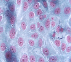 細(xì)胞侵襲、轉(zhuǎn)染